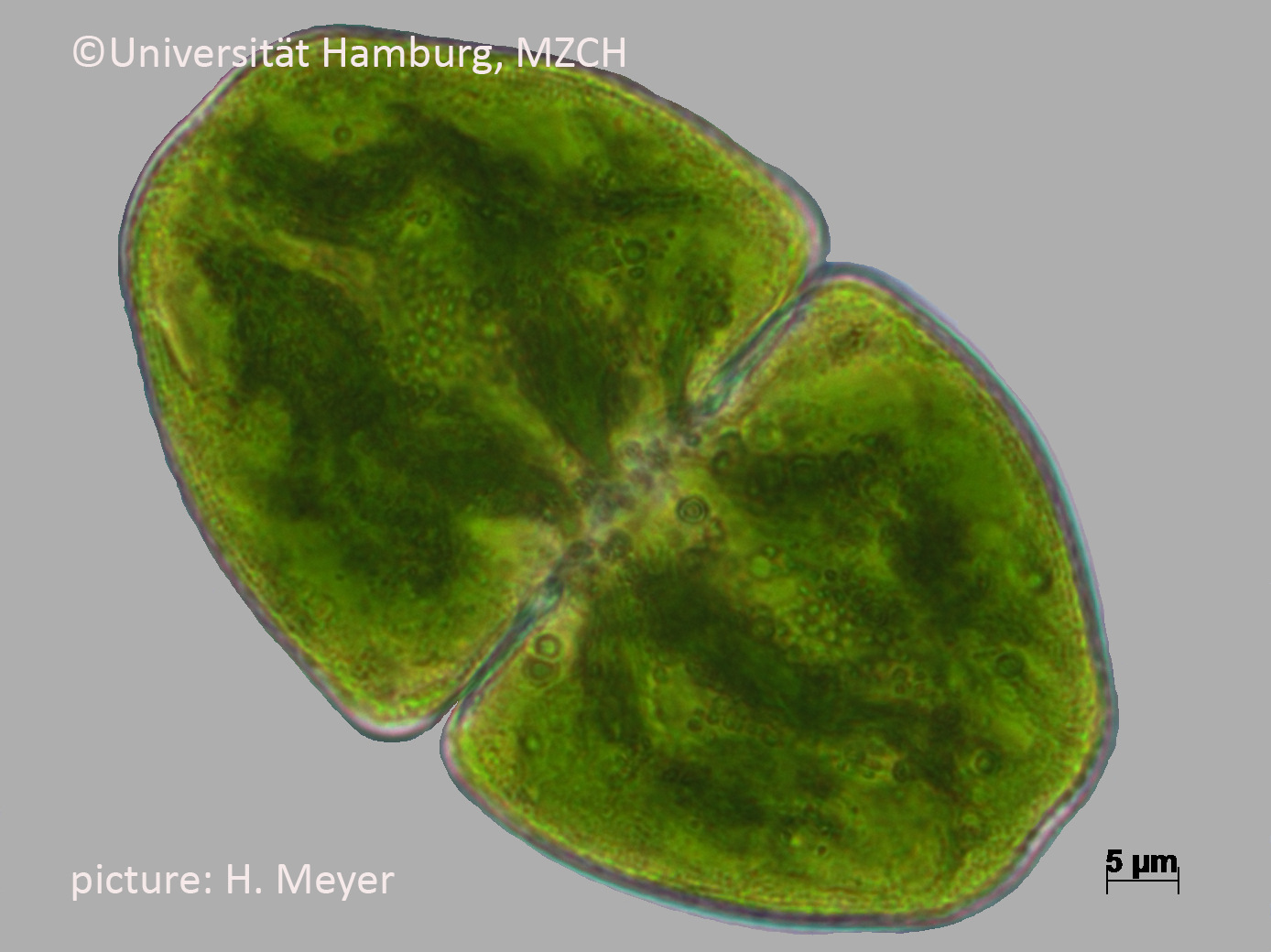 572_Cosmarium pyramidatum_1000x-11_H. Meyer.bmp